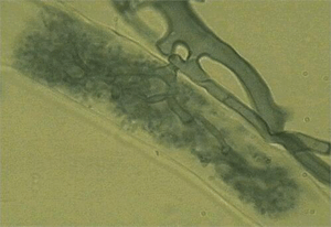 Арбускулярная микориза у клевера (арбускулы в клетке кортекса корня)