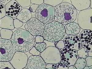 Арбускулярная микориза: грибные гифы в клетках корня орхидеи.