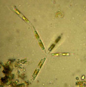 Диатомея Nitzschia frigida – типичный обитатель арктических льдов. Фото с сайта http://www.polar.se.