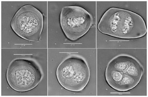 Мейоз, предшествующий образованию пыльцевых зерен у лука (слева направо и сверху вниз). Фото с сайта http://laurent.penet.free.fr