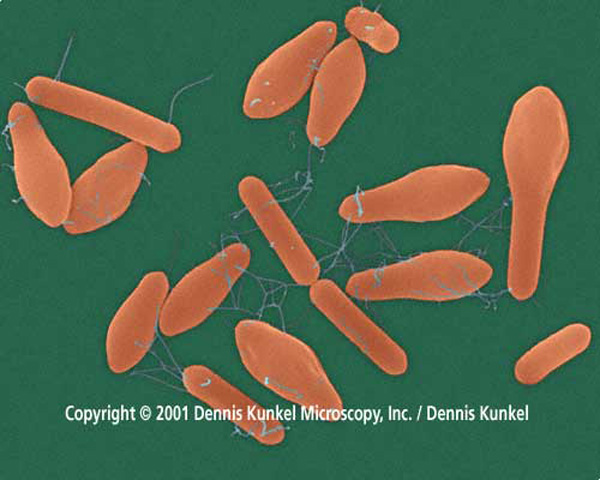 <i>Clostridium botulinum</i> – возбудитель ботулизма. Клетки в форме бутылок содержат внутри эндоспоры. По мнению Г. Г. Гончикова, процесс формирования эндоспор был важной предпосылкой появления клеточного ядра у предков эукариот.