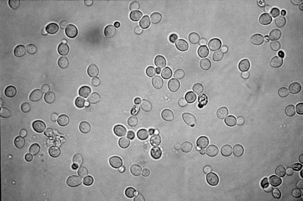 Дрожжи <i>Saccharomyces cerevisiae</i>. Фото © J.-M. Salmon INRA (с сайта http://www.planet-techno-science.com)