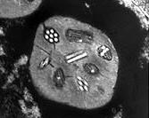 Вирусы ядерного полиэдроза образуют в клетках зараженных насекомых крупные многогранные капсулы, набитые палочковидными вирусными частицами. На фотографии – срез такой капсулы; «стопки» вирусных частицы разрезаны под разными углами.