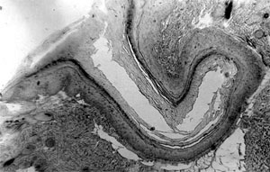 На микрофотографии — срез дополнительного мешочка