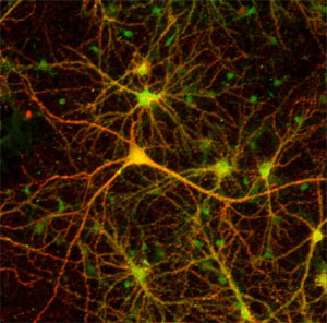 Из культуры клеток человека или животного можно вырастить в пробирке искусственную нейронную сеть, побудив клетки превратиться в нейроны и установить контакты между собой. Такие сети демонстрируют способность к обучению (изображение с сайта www.bio.sci.osaka-u.ac.jp)