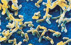 Микроорганизмы – возбудители чумы <i>Yersinia pestis</i> под микроскопом