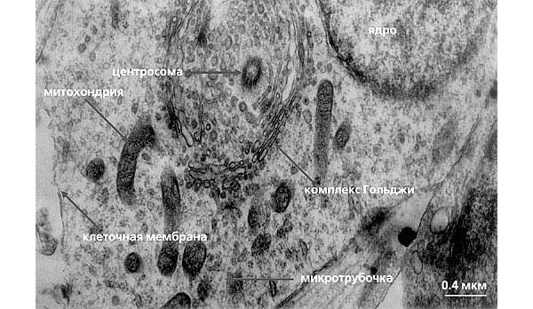 Рис. 7. Центросома, окруженная комплексом Гольджи. На ультратонком срезе располагается одна центриоль из пары. Масштабный отрезок 0,2 мкм