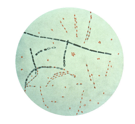 Возбудитель сибирской язвы Bacillus anthracis. Видны споры. Иллюстрация Public Health Image Library с сайта phil.cdc.gov