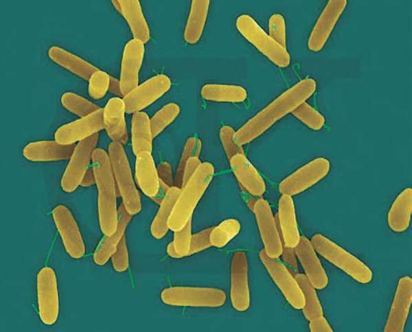 Синегнойная палочка Pseudomonas aeruginosa. Фото Pseudomonas genome database с сайта pseudomonas.com