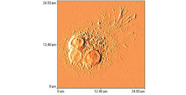 Разновидность лейкоцитов — фагоцит; его поверхность выглядит пушистой из-за отростков — псевдопий, которыми он захватывает бактерии. Изображение получено на атомно-силовом микроскопе Topometrix AccurexTM (США) в лаборатории сканирующей зондовой микроскопии научно-образовательного центра “Физика твердотельных наноструктур” Нижегородского государственного университета им. Лобачевского (НОЦ ФТНС ННГУ). Авторы — Ю.Ю. Гущина, С.Н. Плескова, биологическая группа. Изображение: «Наука и жизнь»