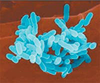 Бактерии группы протея (Proteus) — сапрофиты — участвуют в гнилостных процессах. Изображение: «Наука и жизнь»