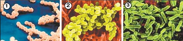 1. Бактерии стрептококки (streptococcus). 2.Бактерии стафилококки (staphylococuss) — небольшие клетки шаровидной формы. В огромном количестве содержатся в гнойниках. Устойчивы ко многим антибиотикам. 3. Синегнойная палочка (Вас. pyocioneus) — гнилостные подвижные бактерии; распространены в окружающей среде. В больничных условиях способны заразить дезинфицирующие растворы (фурацилин) и инструменты. Изображение: «Наука и жизнь»