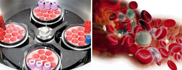 Удаление антигенов (Изображение с сайта www.popmech.ru)