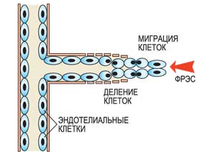 Процесс ангиогенеза начинается с разрушения сосудистой оболочки ферментами – протеазами, которые под действием молекул фактора роста эндотелия сосудов (ФРЭС) вырабатывают активированные клетки эндотелия. После этого клетки могут делиться и мигрировать по направлению к опухоли