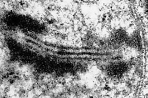 Рис. 2. Ультратонкий продольный срез синаптонемного комплекса свиной аскариды Ascaris suum, состоящего из двух латеральных и центрального элементов. К латеральным элементам прилегает плотно конденсированный хроматин. Центральный элемент формируется перекрыванием белковых зубцов «застежки-молнии». Фото автора. Изображение: «Природа»