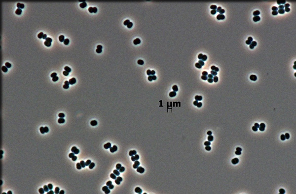 Tersicoccus phoenicis. Image provided by Leibniz-Institute DSMZ and Jet Propulsion Laboratory, California Institute of Technology