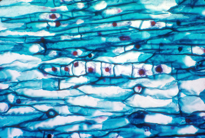 Омела внутри тканей хозяина