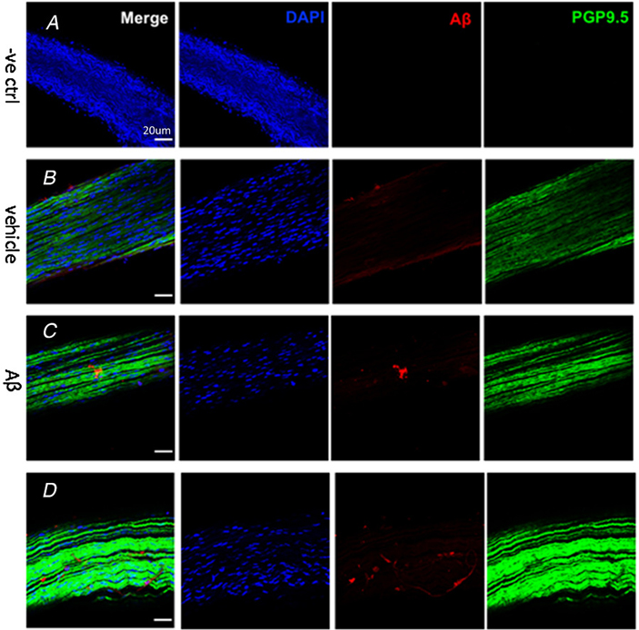 Накопление бета-амилоида в блуждающем нерве мышей