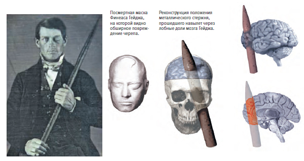 По-видимому, на этой дагерротипии (очень ранней разновидности фотографии) Финеас Гейдж. В течение многих лет ее владельцы, собиратели старинных изображений Джек и Беверли Уилгус, полагали, что на ней запечатлен переживший столкновение с разъяренным китом китобой с гарпуном в руках. Однако в 2008 году один историк встретил эту картинку в интернете и предположил, что на ней может быть изображен Финеас Гейдж, портреты которого ранее не были известны. Разыскания, проведенные после этого Уилгусами, показали, что это почти наверняка так и есть.
