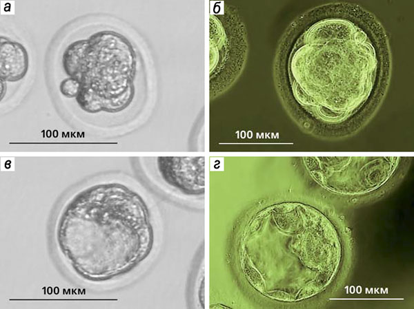 Рис. 1. Преимплантационные эмбрионы («Природа» №3, 2015)