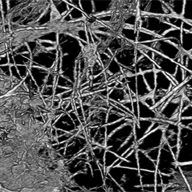 Объемная реконструкция грибных нитей