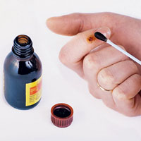 Почему йод жжётся?