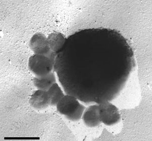 Крупная клетка термофильной археи Ignicoccus hospitalis с облепившими ее мелкими клетками паразитической археи Nanoarchaeum equitans. Длина масштабной линейки 1 мкм. Фото с сайта www.astronomie.de