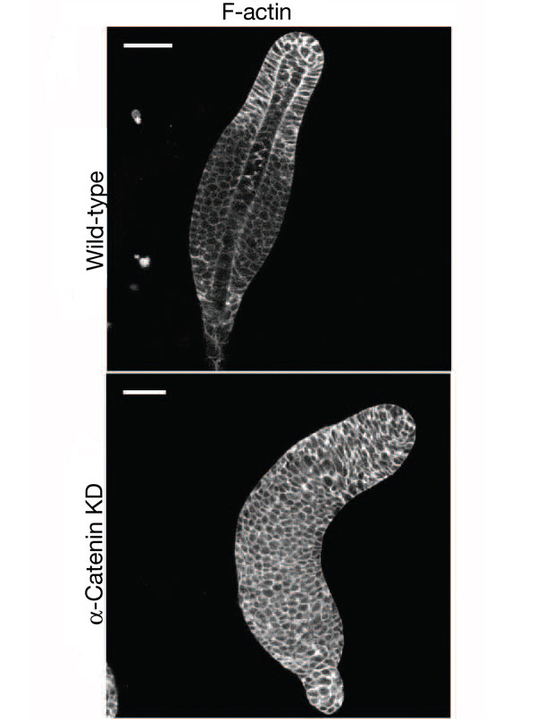 Рис. 3. Ранние этапы формирования плодового тела в норме (вверху) и у амёб с выключенным геном альфа-катенина (внизу). Фото из обсуждаемой статьи в Science
