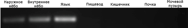 Экспрессия РНК гена белка-переносчика мочевины UT в разных тканях трионикса