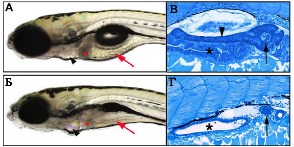 Пятидневные мальки данио имеют нормально развитый кишечник (он хорошо виден на продольном срезе А) и поджелудочную железу (показана черным треугольником на срезе В). Зато у мутантных экземпляров эти органы пищеварительного тракта развиты плохо (Б и Г). Красной стрелкой показаны складки кишечного эпителия, черным треугольником — поджелудочная железа, звездочкой — просвет кишечника, черной стрелкой — неизмененные островковые клетки поджелудочной железы и у нормальных эмбрионов и у мутантов. Фото из обсуждаемой статьи в PLoS Biology