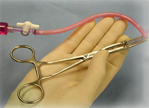 Готовый сосуд, выращенный из клеток пациента по технологии компании Cytograft Tissue Engineering (фото с сайта www.cytograft.com)