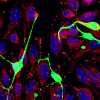 Нейрональные стволовые клетки из поджелудочковой зоны (SVZ-NSC), смешанные с клетками рака молочной железы 4T1