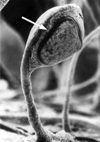 Спящая личинка Caenorhabditis elegans (белая стрелка) в многоклеточном плодовом теле почвенной амебы Dictyostelium. Фото с сайта www.cumc.columbia.edu