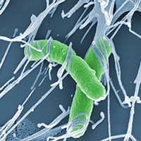 Shigella flexneri