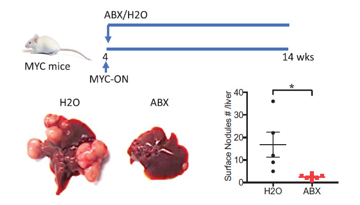 Рис. 2. Подавление бактерий пищеварительного тракта подавляет и развитие рака печени