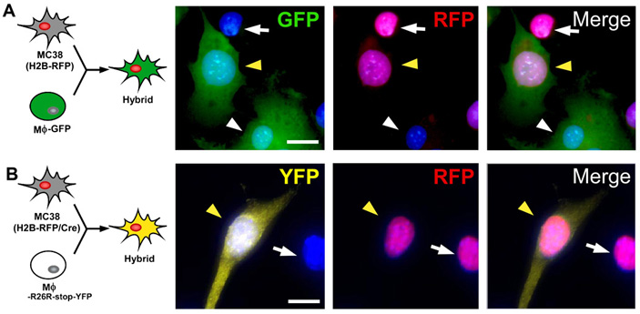 Рис. 1. Слияние клеток опухоли и макрофагов