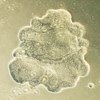 Трихоплакс (Trichoplax adhaerens)