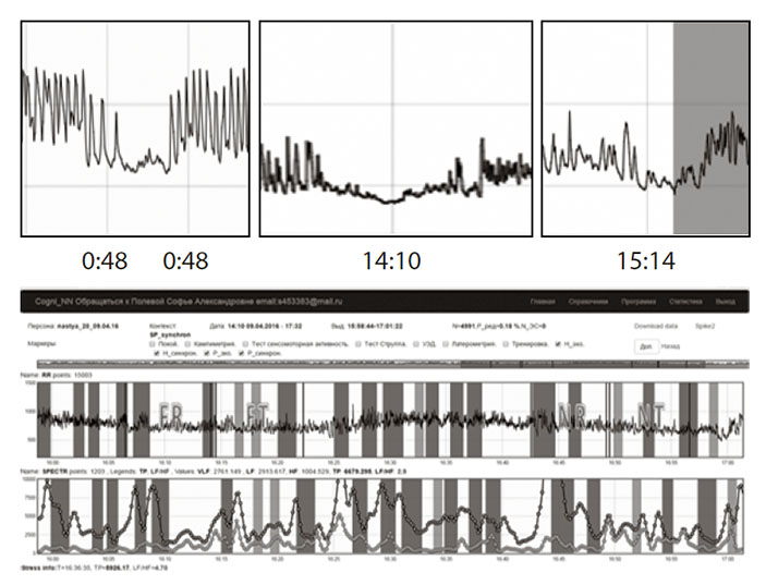 Сергей Парин. Стресс, боль и опиоиды