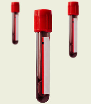 Пробирки с кровью («Горький»)