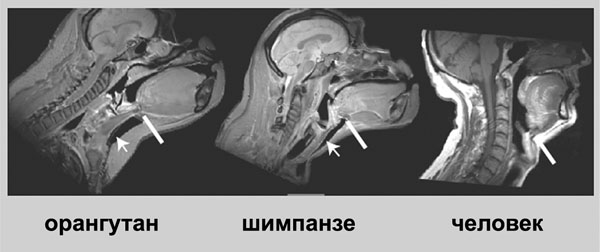 Рис. 8.3. Анатомии вокального тракта орангутана, шимпанзе и человека («Эволюция языка»)