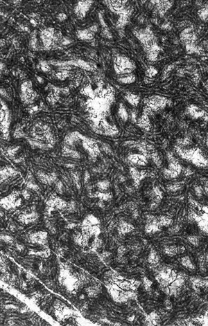 Рис. 10.2. Обызвествленные чехлы возможных цианобактерий Girvanella (диаметр 30 мкм); кембрий (510 млн лет); хр. Западный Саян, Хакасия