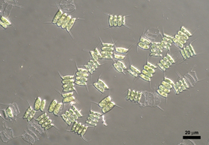 Зеленая водоросль Scenedesmus quadricauda. 