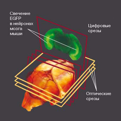 Лазерная плосколучевая оптическая томография