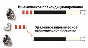 Рис. 6. Предварительные кратковременные перебои в кровоснабжении сердца смягчают последствия инфаркта («Химия и жизнь» №6, 2016)