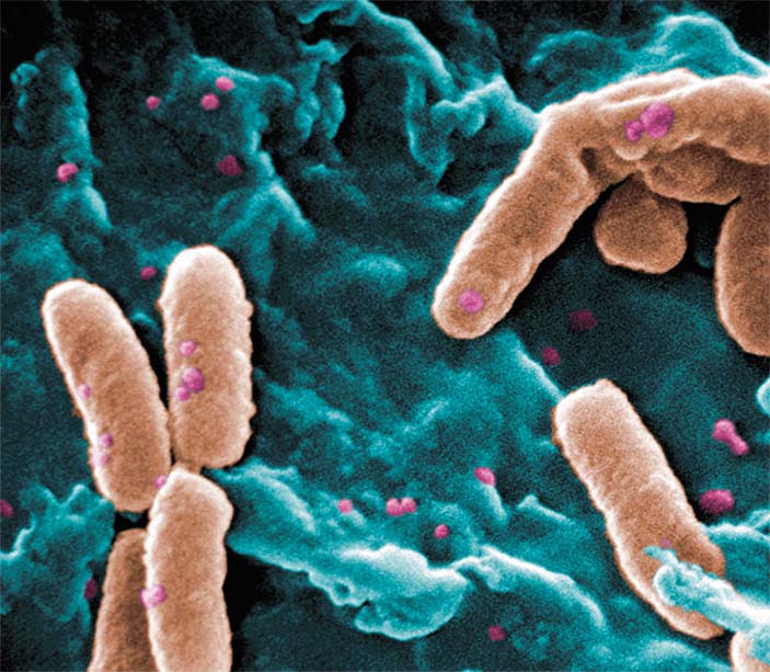 Синегнойная палочка (Pseudomonas aeruginosa)