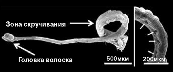 <b>Рис. 4.</b> Волосок-катапульта австралийской росянки. <i>Справа</i> — шарнирная зона крупным планом. На ней отчетливо видны впадинки, возникшие на месте «сдувшихся» клеток