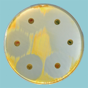 Золотистый стафилокок