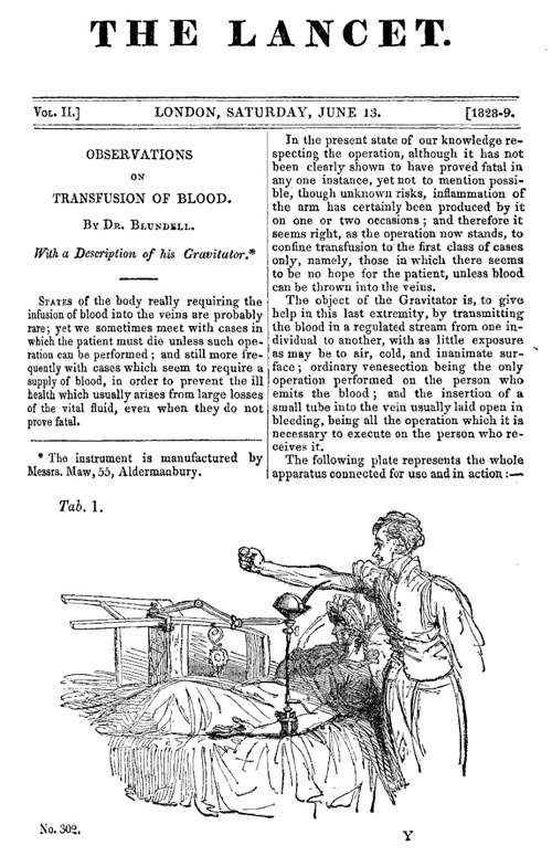 Британский медицинский журнал “The Lancet”, 1828 год, статья о переливаниях крови