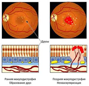 Лишний вес и тренированный иммунитет 3