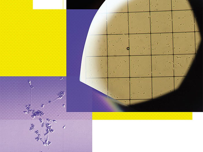 Интенсивность выработки антител к собственным сперматозоидам пациента определяют с помощью MAR-теста («Наука из первых рук» № 1(77), 2018)